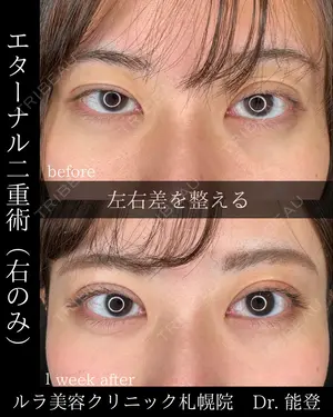 before image