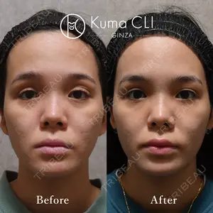 90 days after image