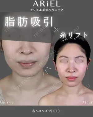 180 days after image