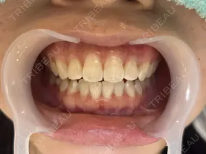 before image