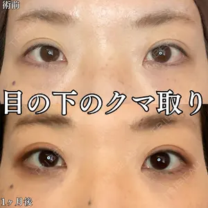 30 days after image