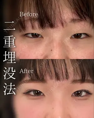 before image