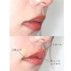 before image