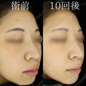 before image