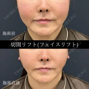 before image