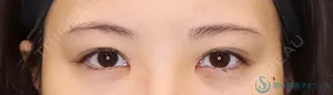 90 days after image