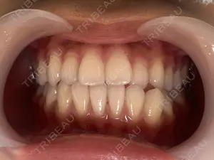 before image
