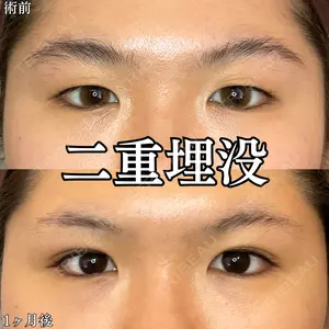 30 days after image