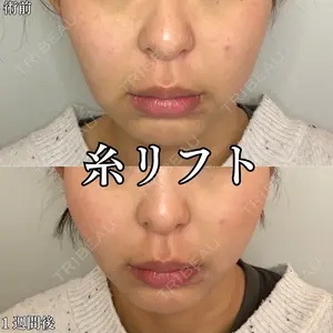 7 days after image