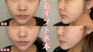 0 days after image
