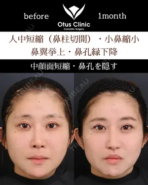 30 days after image