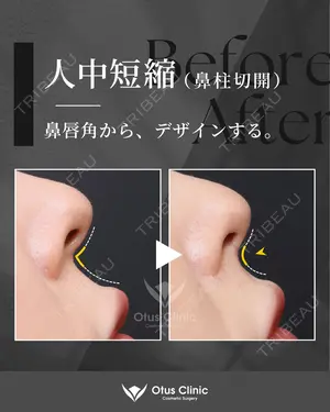 180 days after image