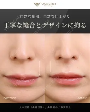180 days after image