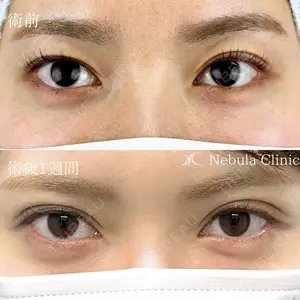 before image