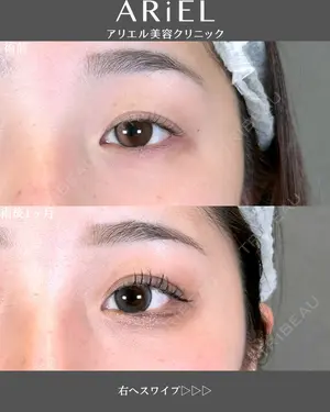 30 days after image