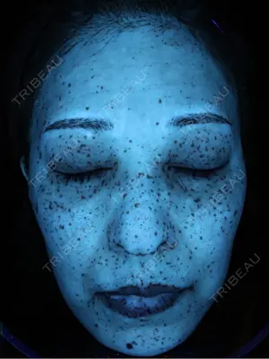 90 days after image