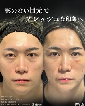 7 days after image