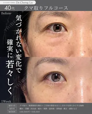 7 days after image