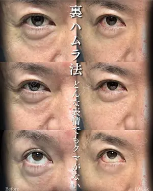 30 days after image