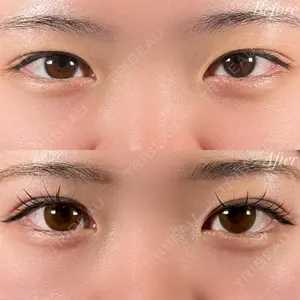 before image