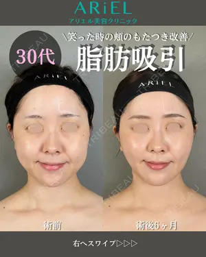 180 days after image