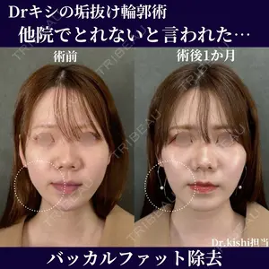 30 days after image