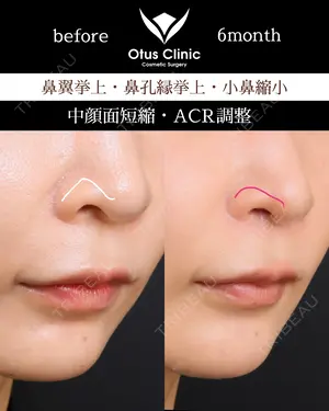 180 days after image
