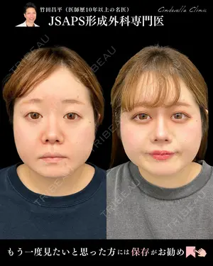 30 days after image