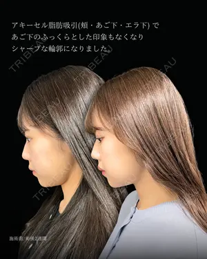 14 days after image