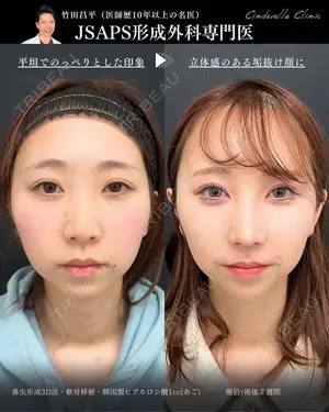 14 days after image
