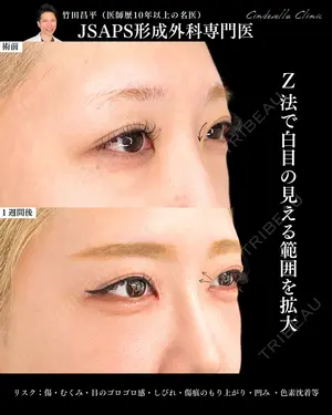 7 days after image
