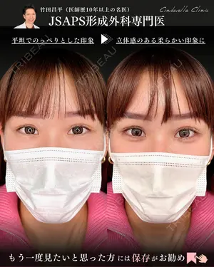 0 days after image