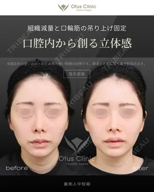 before image