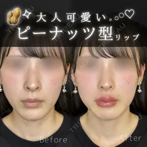 0 days after image