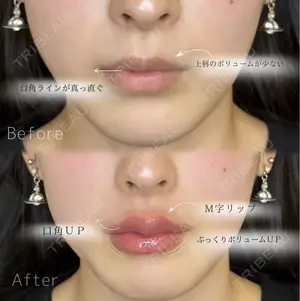 0 days after image