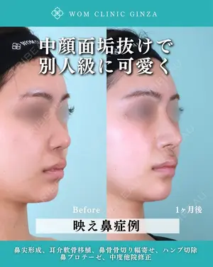 30 days after image