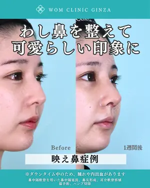 7 days after image