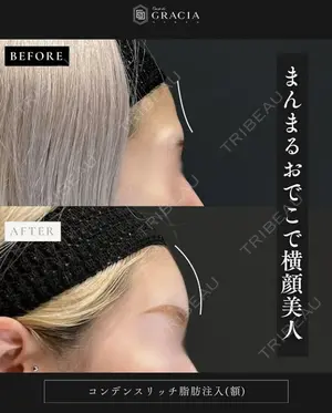 before image