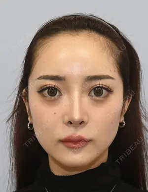 90 days after image
