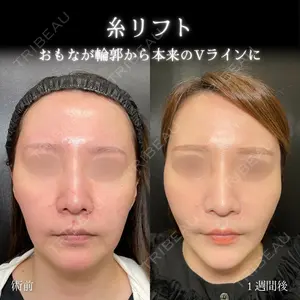 7 days after image