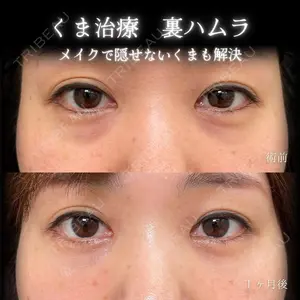 before image
