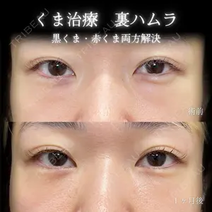 30 days after image