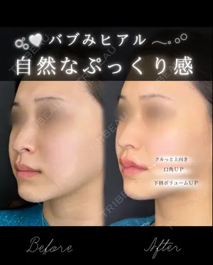 0 days after image