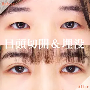 before image