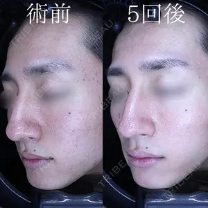 before image