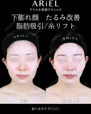 180 days after image