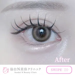 30 days after image