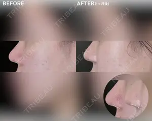 before image
