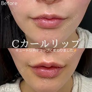before image