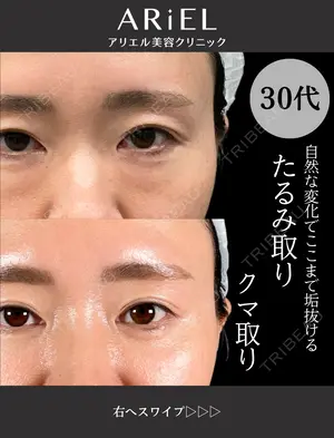 30 days after image